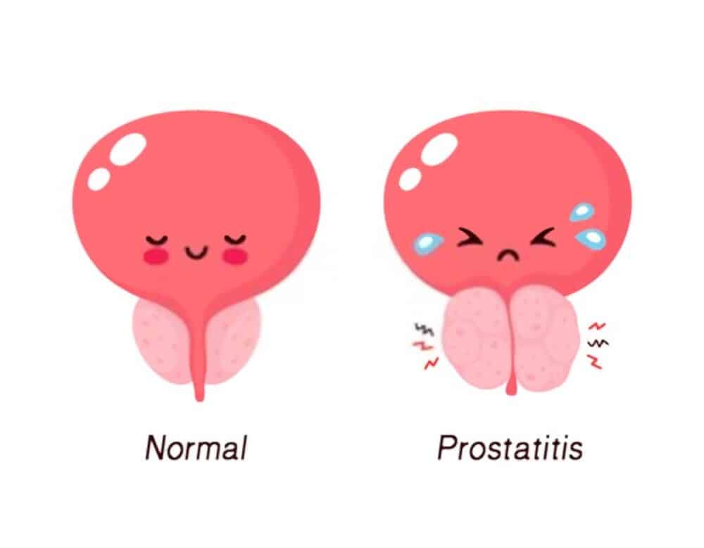 VitalFlow Prostate Supplement