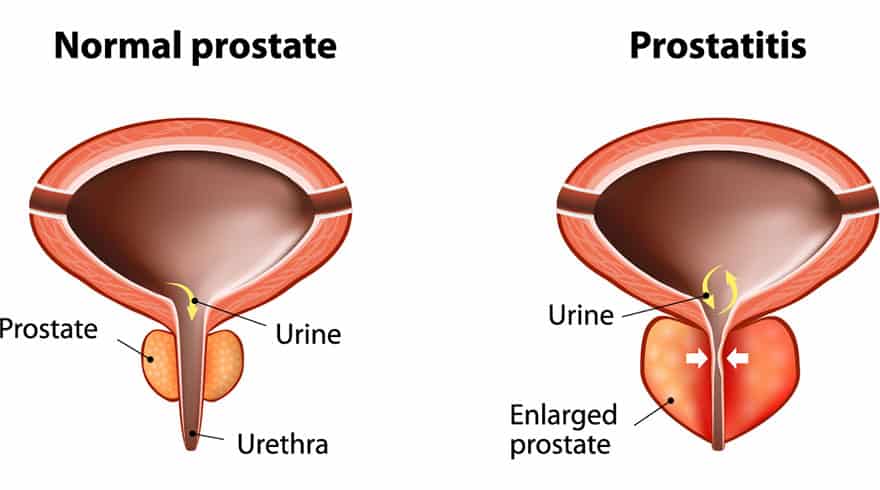 ProstaStream-to-improve-prostate-health