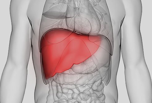 Hemochromatosis