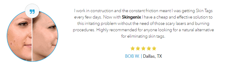 Skingenix Reviews