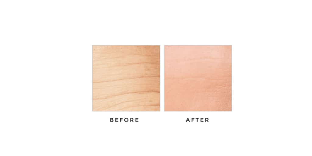 Derma Progenix before & after results