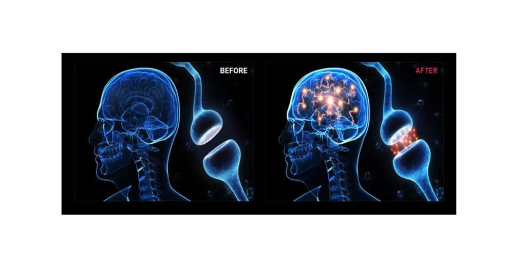 Cognivex Supplement Before & After