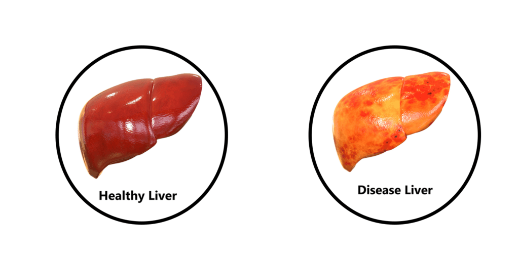 Liver Health Formula Side Effects