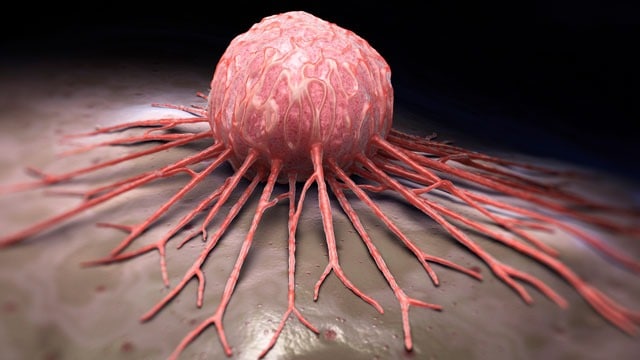 A Recent Study Has Discovered A Fundamental Denominator That Connects All Tumors