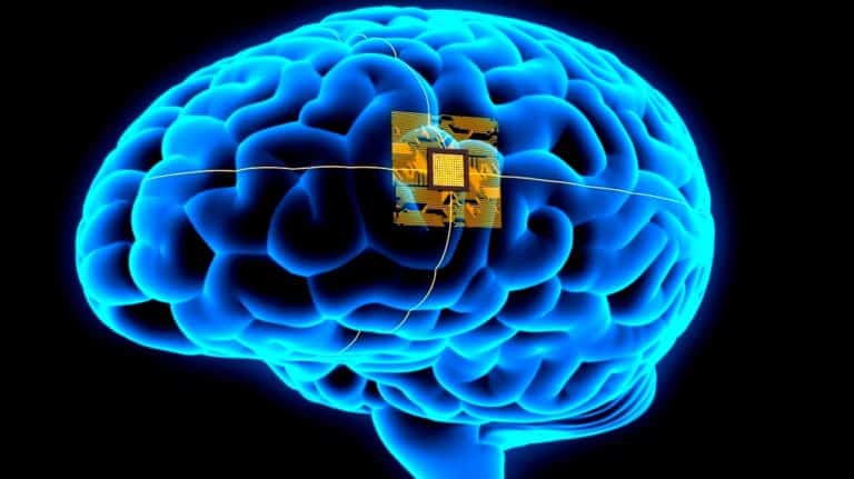 Brain Implant Helps Man ‘Speak’ Through A Computer