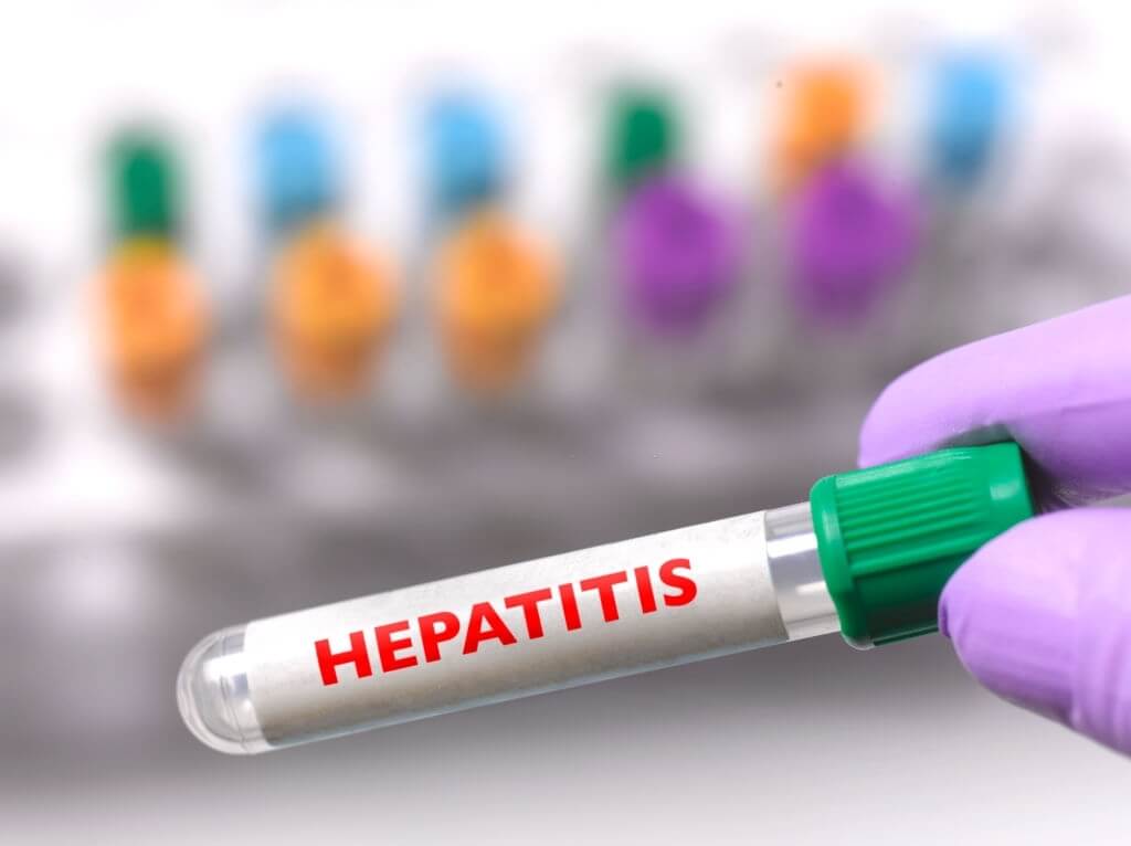 Hepatitis Medical Myths: A Look At The Facts