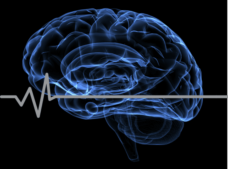 Scientists Translate Brain Waves Of Man With Paralysis Into Words