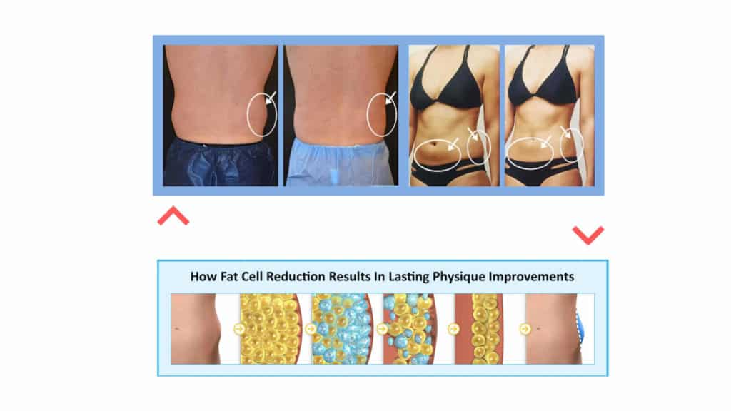 Benefits of The Fat Cell Killer Weight Loss Program