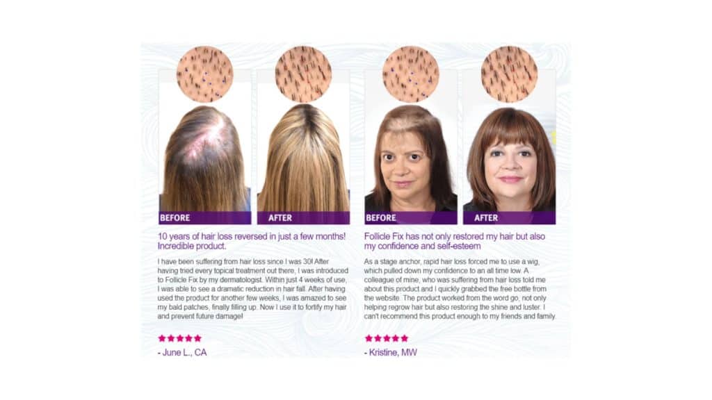 Follicle Fix Customer reviews