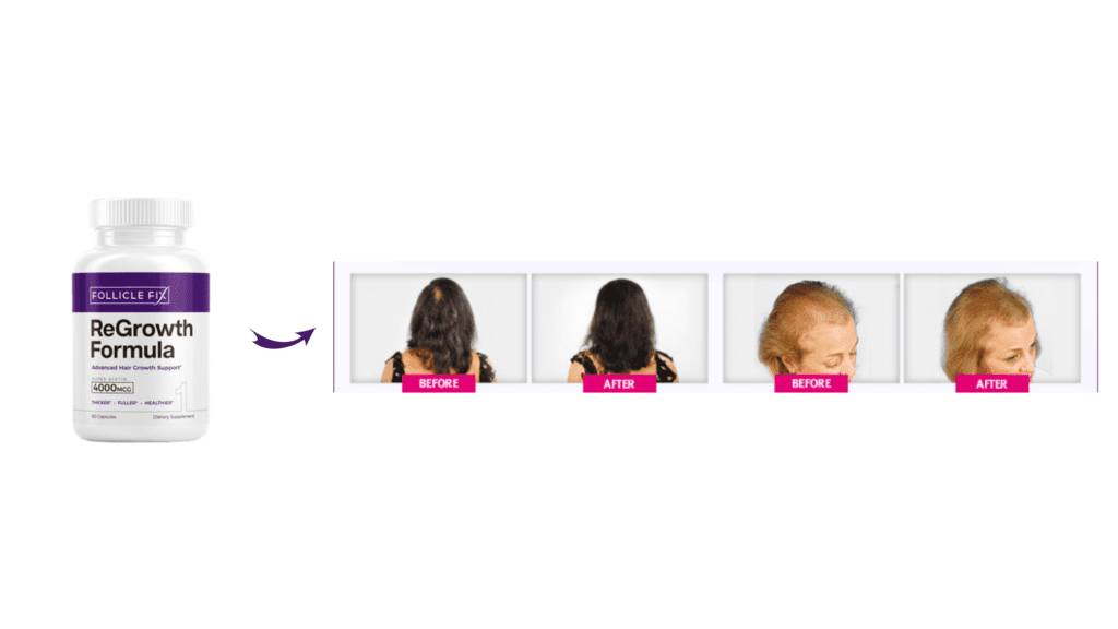 Follicle Fix Hair Care Formula Results 