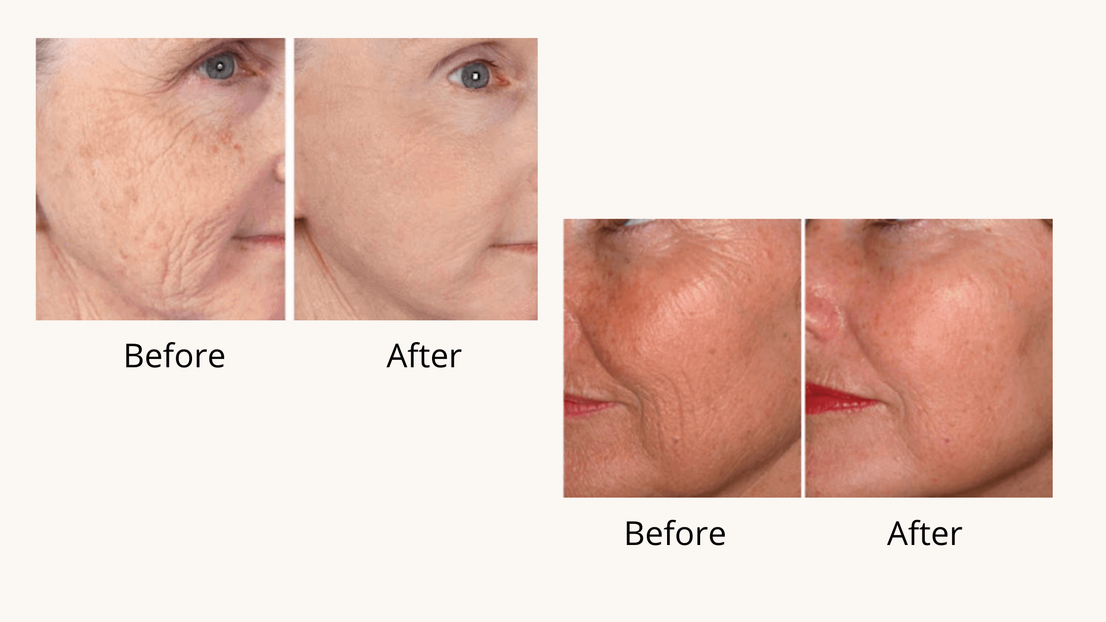 Hydracellum Result