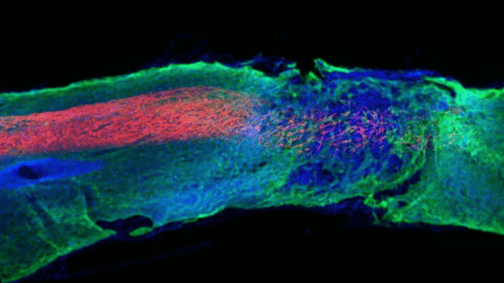 Possible Breakthrough Against Spinal Injury