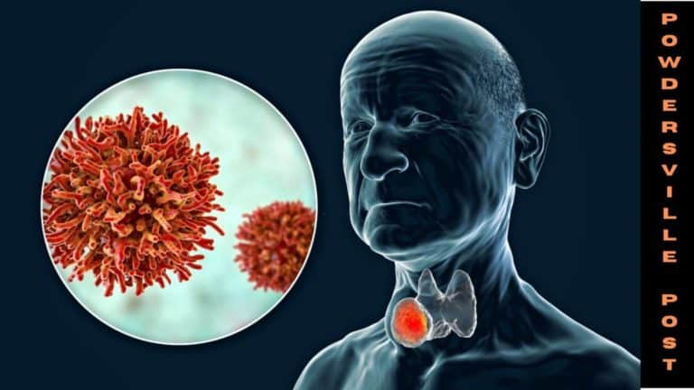 The Rise In Rates Of Throat Cancer In The United States