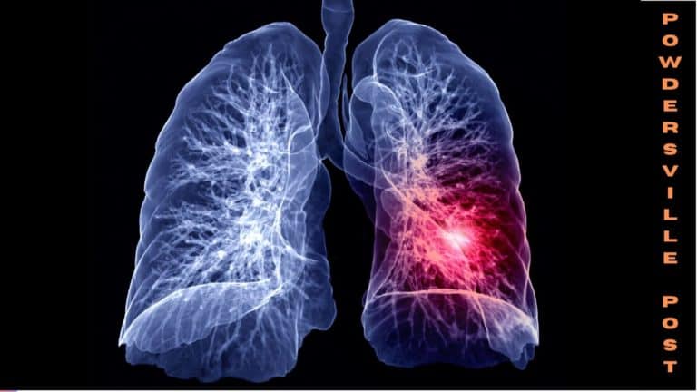 The Decline In Deaths From Lung Cancer