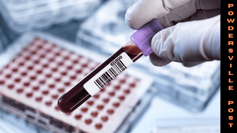 A Blood Test Is Highly Accurate In Detecting Early Signs Of Alzheimer’s