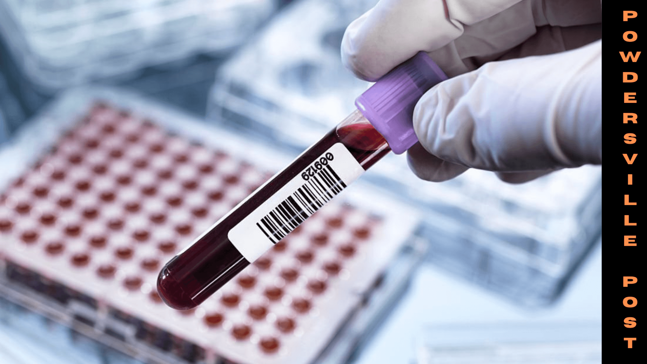 A Blood Test Is Highly Accurate In Detecting Early Signs Of Alzheimer's