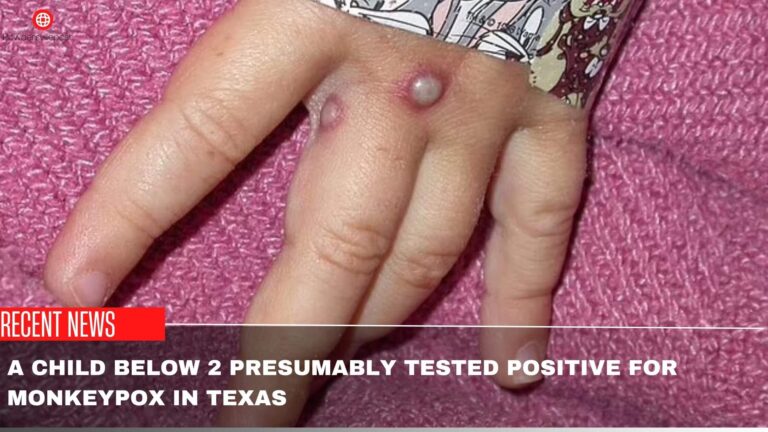 A Child Below 2 Presumably Tested Positive For Monkeypox In Texas