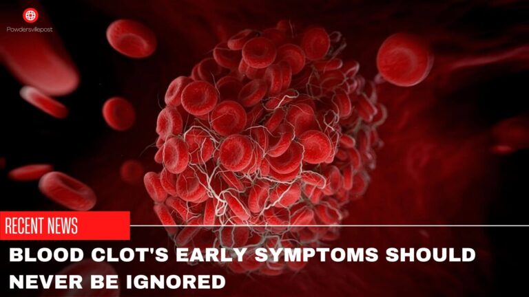 Blood Clot’s Early Symptoms Should Never Be Ignored