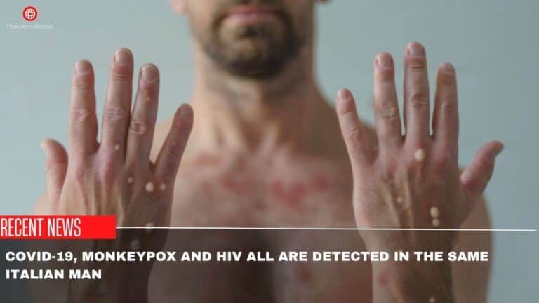 Covid-19, Monkeypox And HIV All Are Detected In The Same Italian Man