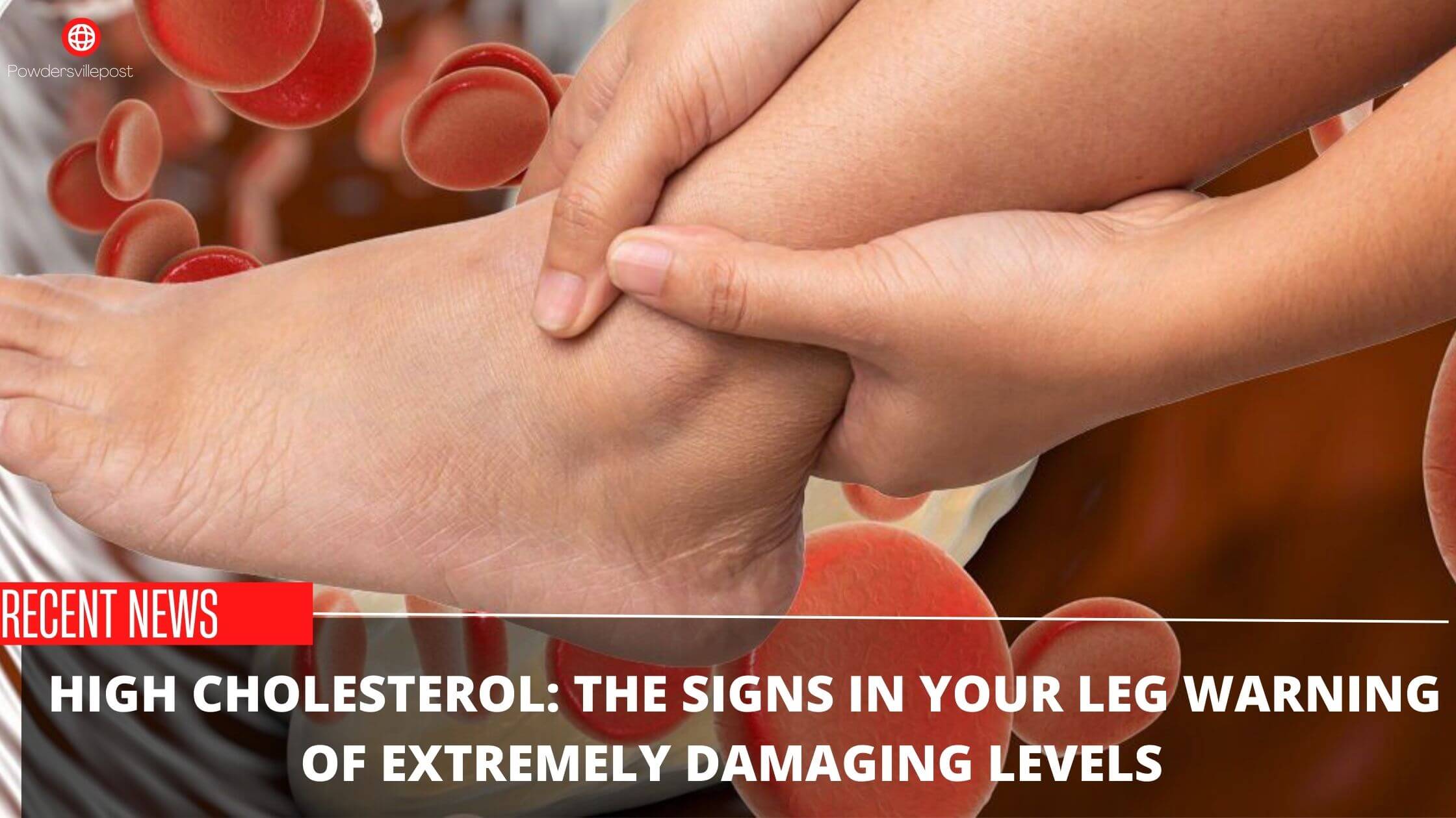 _ High Cholesterol The Signs In Your Leg Warning Of Extremely Damaging Levels
