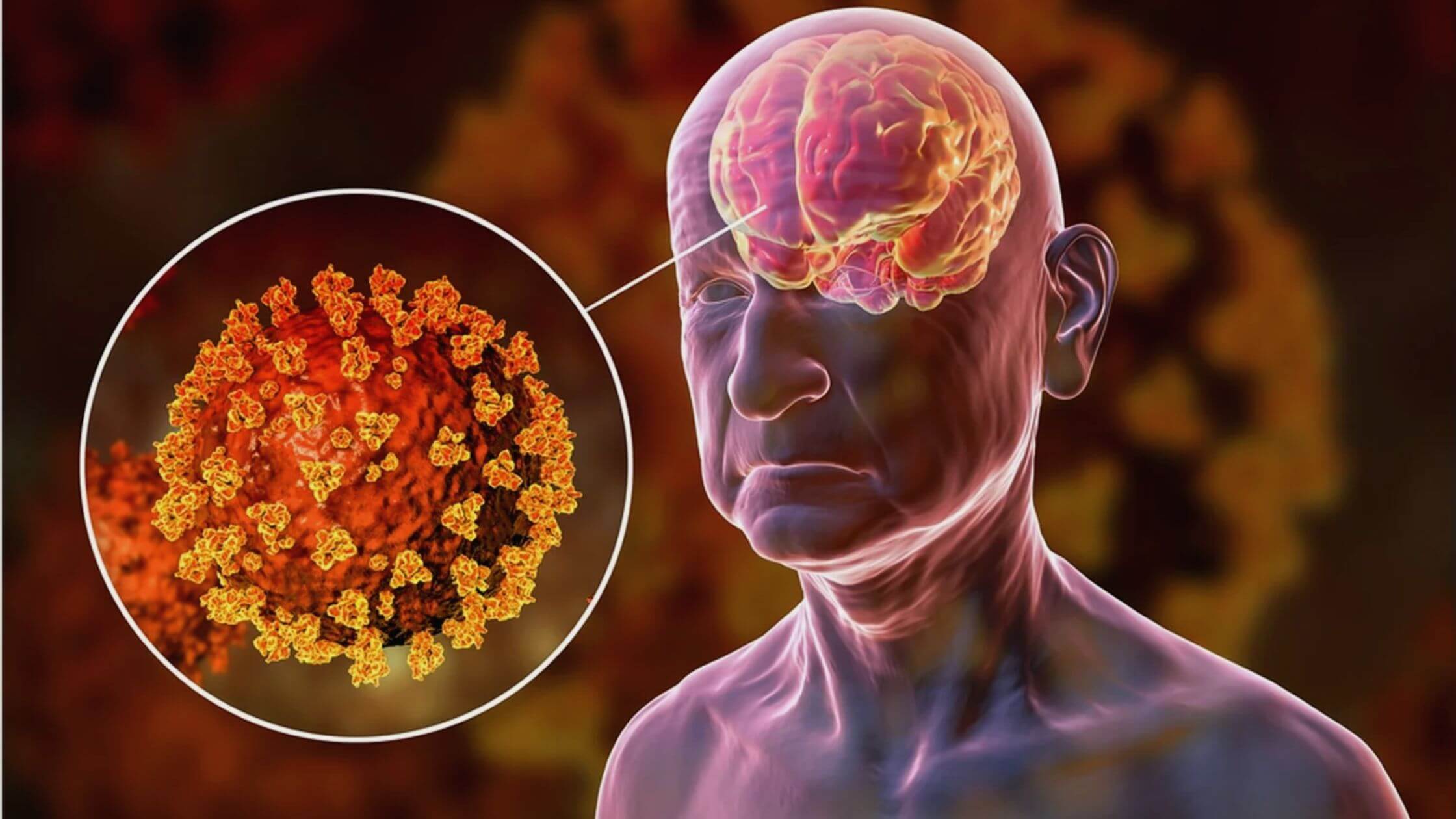 Long-Term Effects Of COVID-19 On The Brain