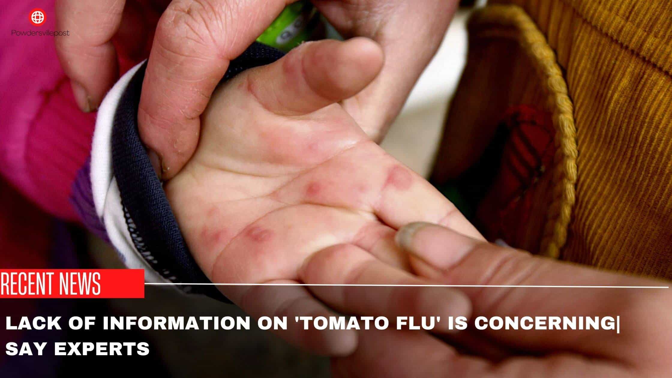 Lack Of Information On ‘Tomato Flu’ Is Concerning| Say, Experts