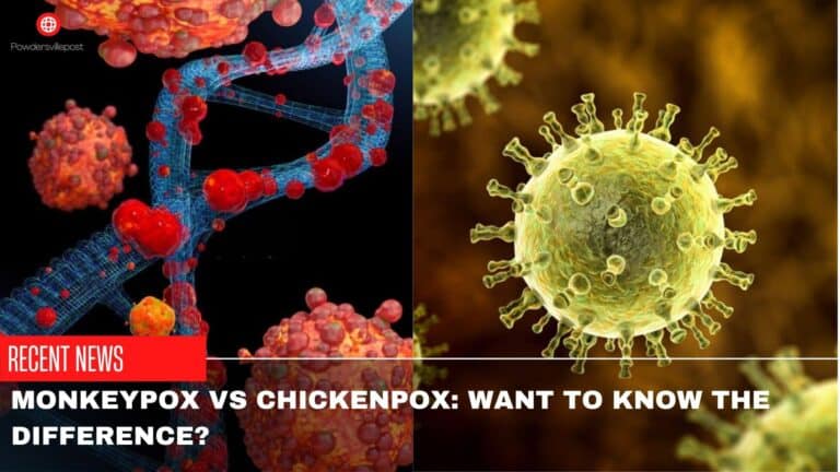 Monkeypox Vs Chickenpox: Want To Know The Difference?