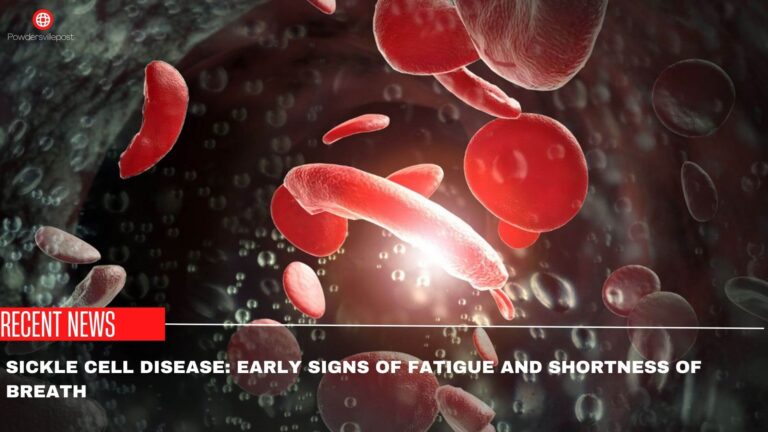 Sickle Cell Disease: Early Signs Of Fatigue And Shortness Of Breath