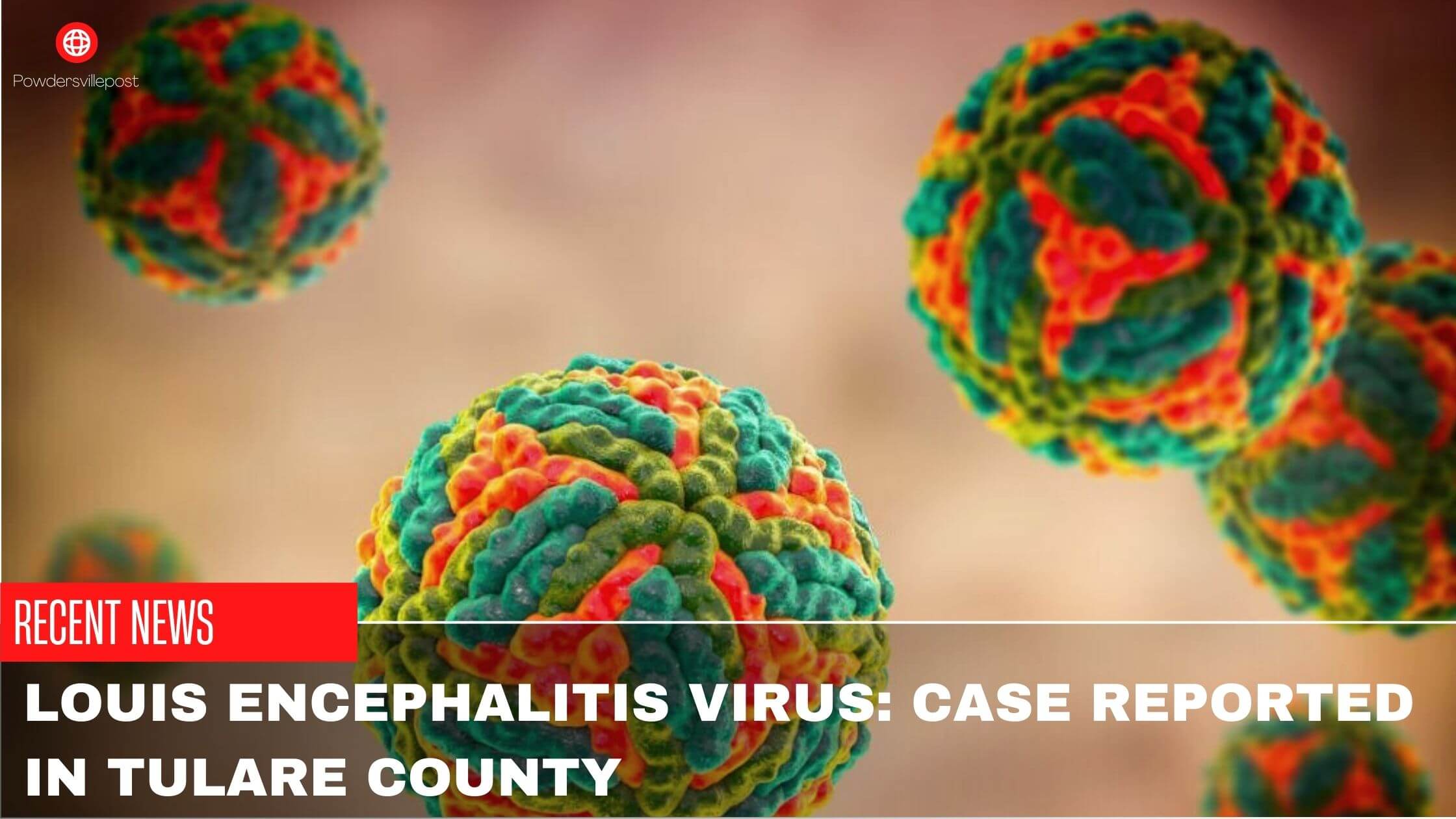 St. Louis Encephalitis Virus Case Reported In Tulare County