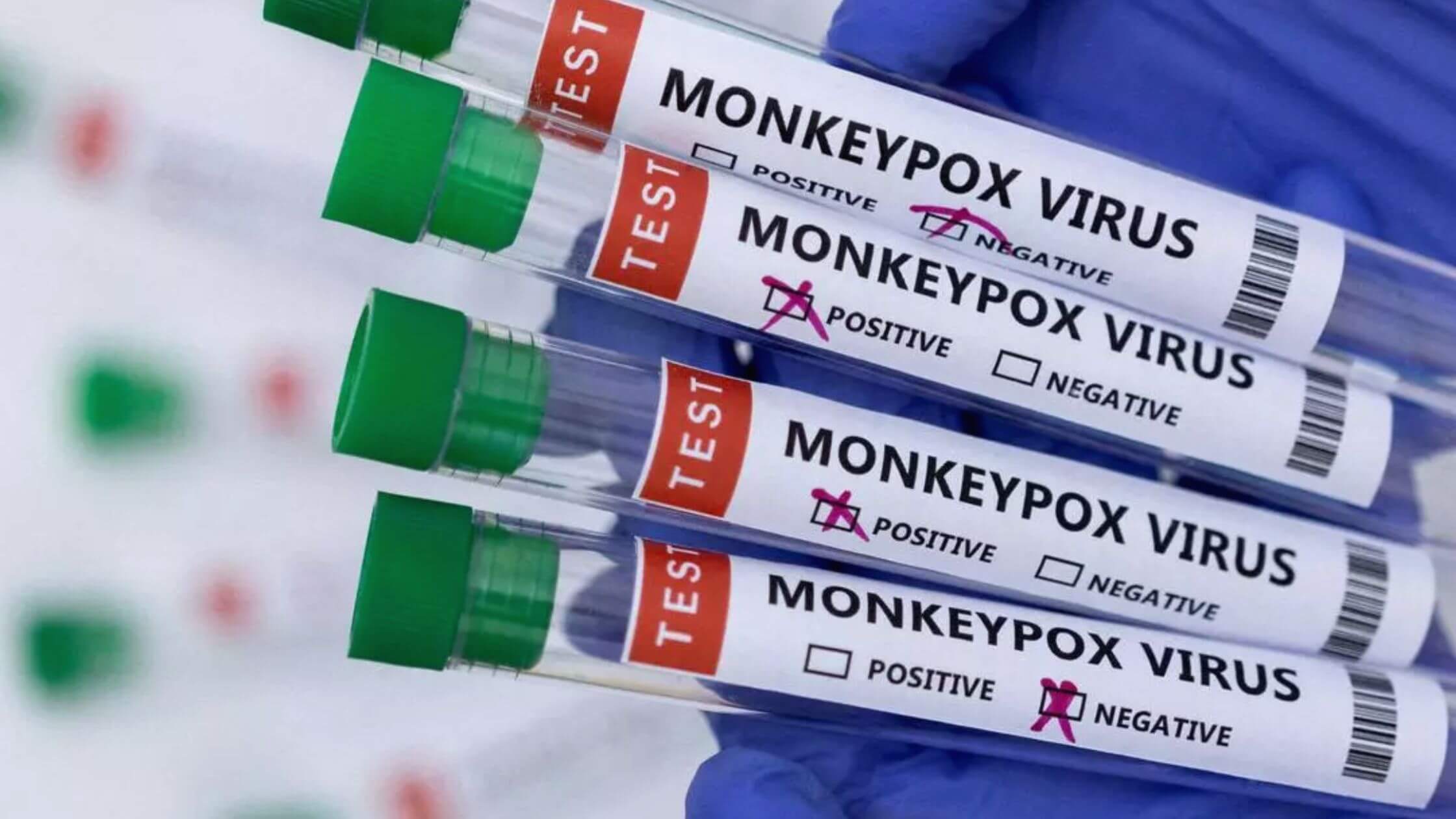 Monkeypox Declared As A National Public Health Emergency