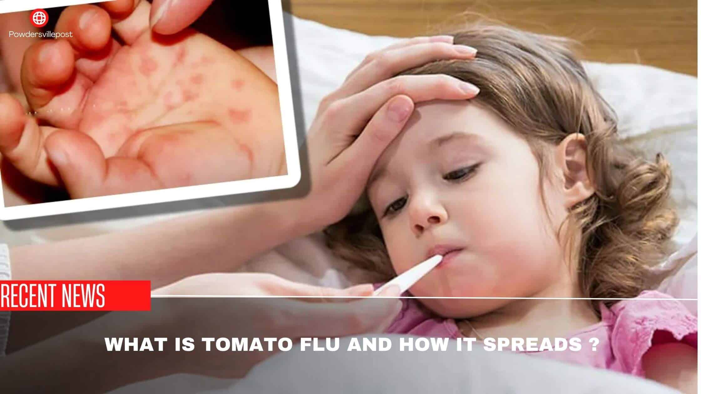 What Is Tomato Flu And How It Spreads