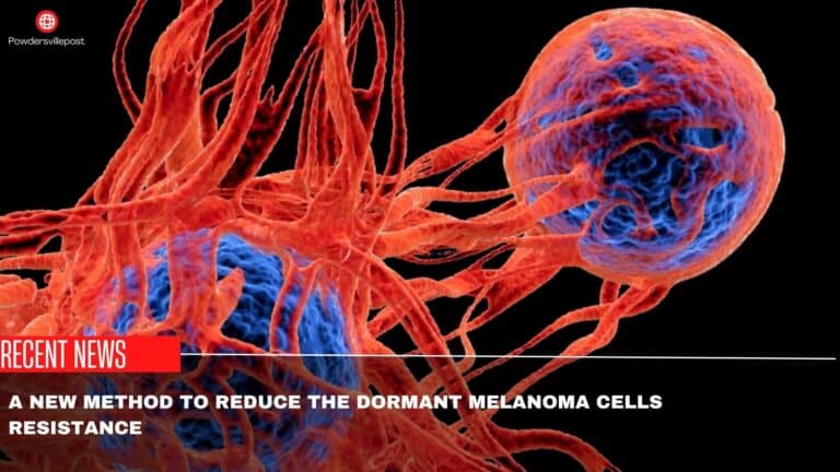 A New Method To Reduce The Dormant Melanoma Cells Resistance: Recent Findings