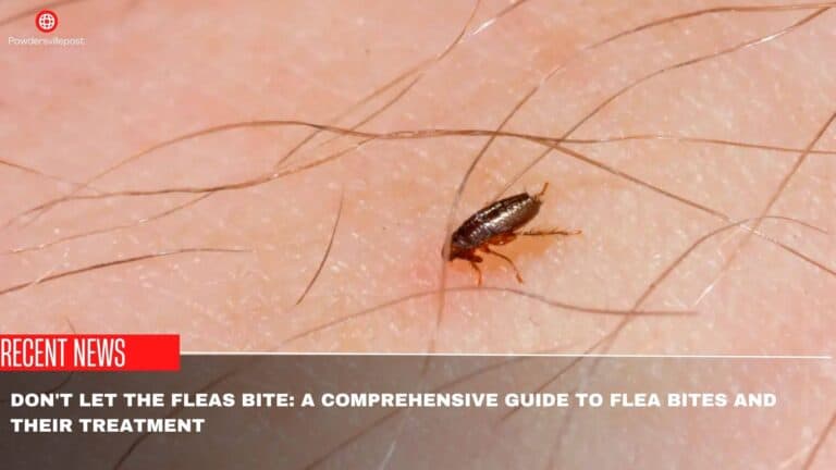 Don’t Let The Fleas Bite: A Comprehensive Guide To Flea Bites And Their Treatment