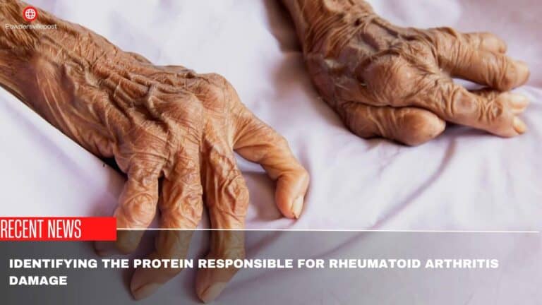 Identifying The Protein Responsible For Rheumatoid Arthritis Damage