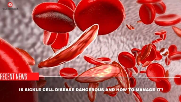 Is Sickle Cell Disease Dangerous And How To Manage It?