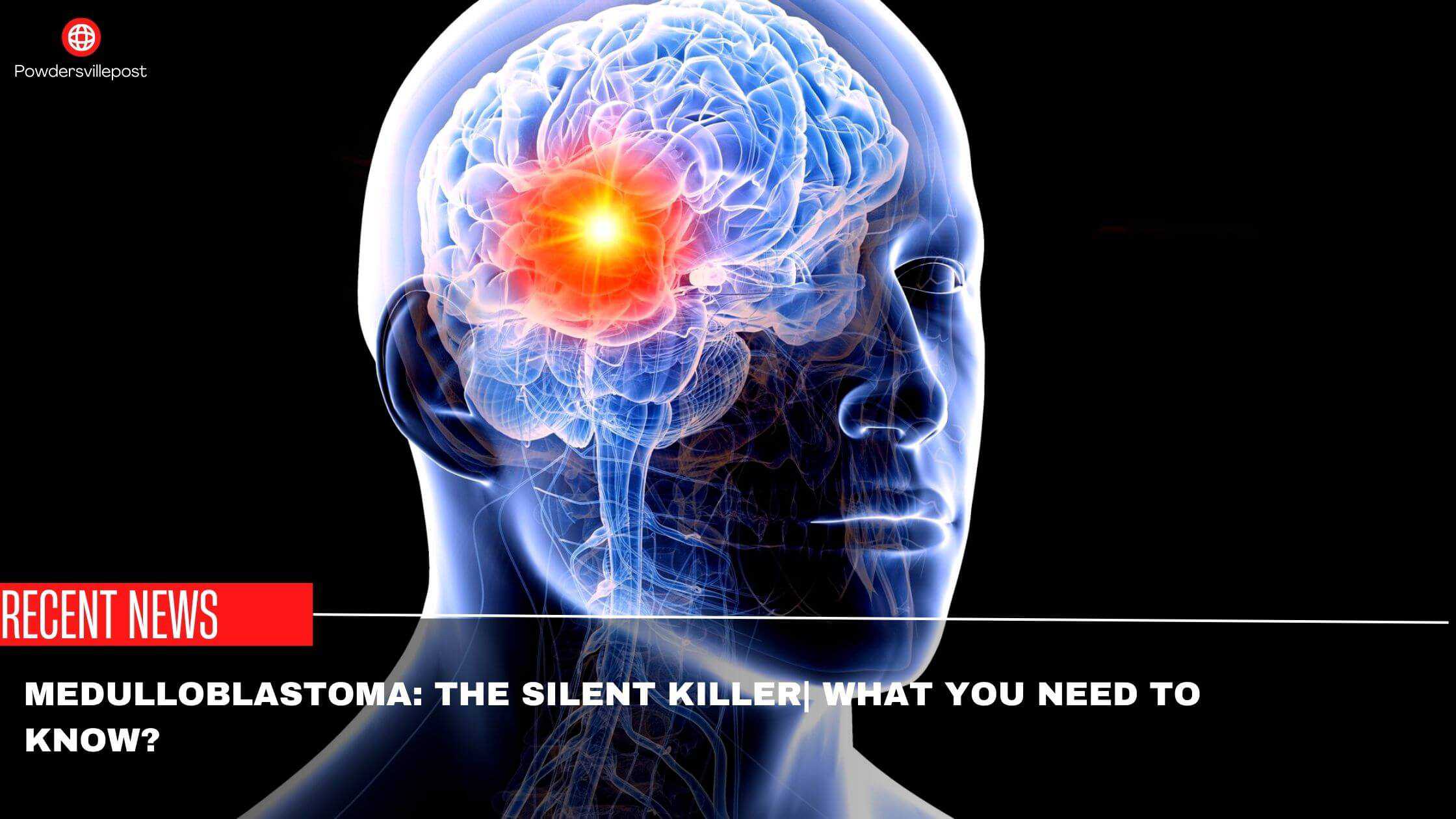 Medulloblastoma The Silent KillerWhat You Need to Know