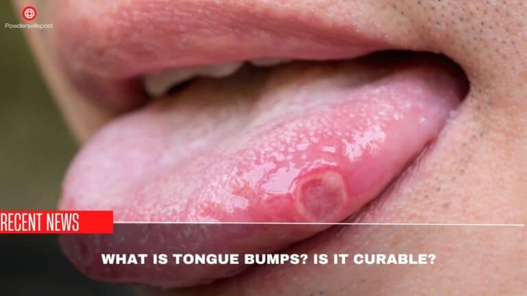 What Is Tongue Bumps? Is It Curable?