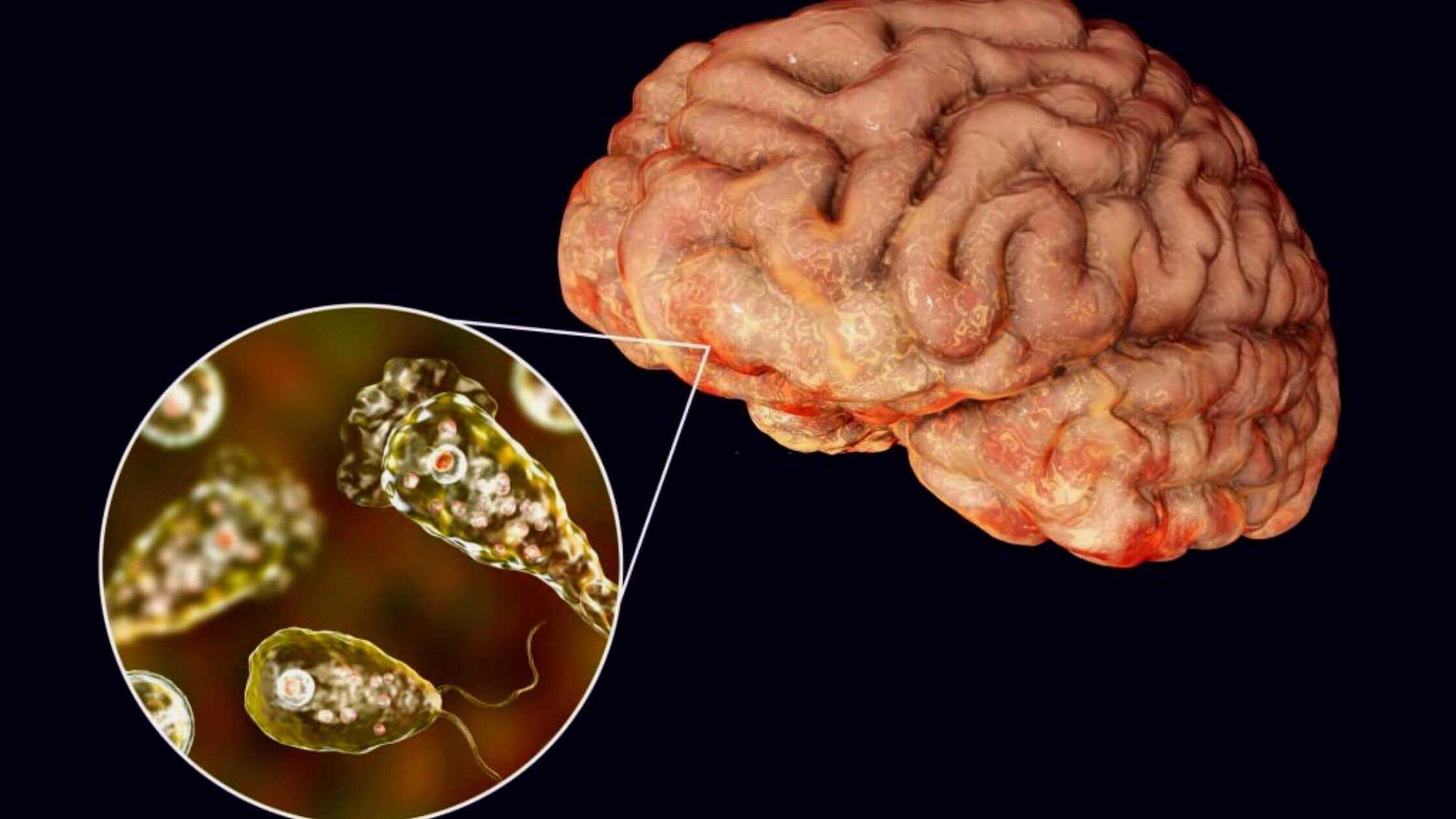 A Boy Dies From Brain-Eating Amoeba In Las Vegas!