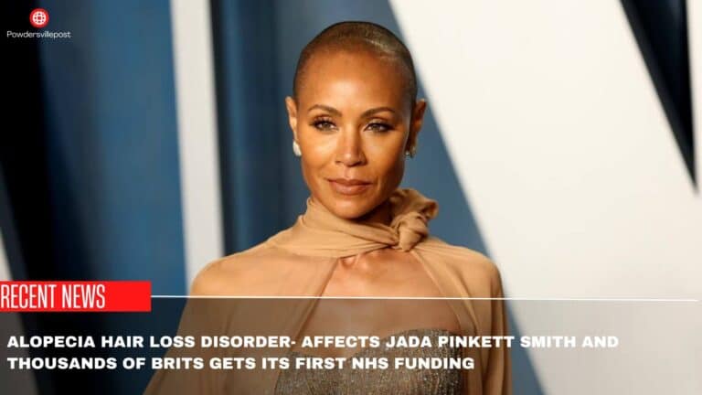 Alopecia Hair Loss Disorder- Affects Jada Pinkett Smith And Thousands Of Brits Gets Its First NHS Funding