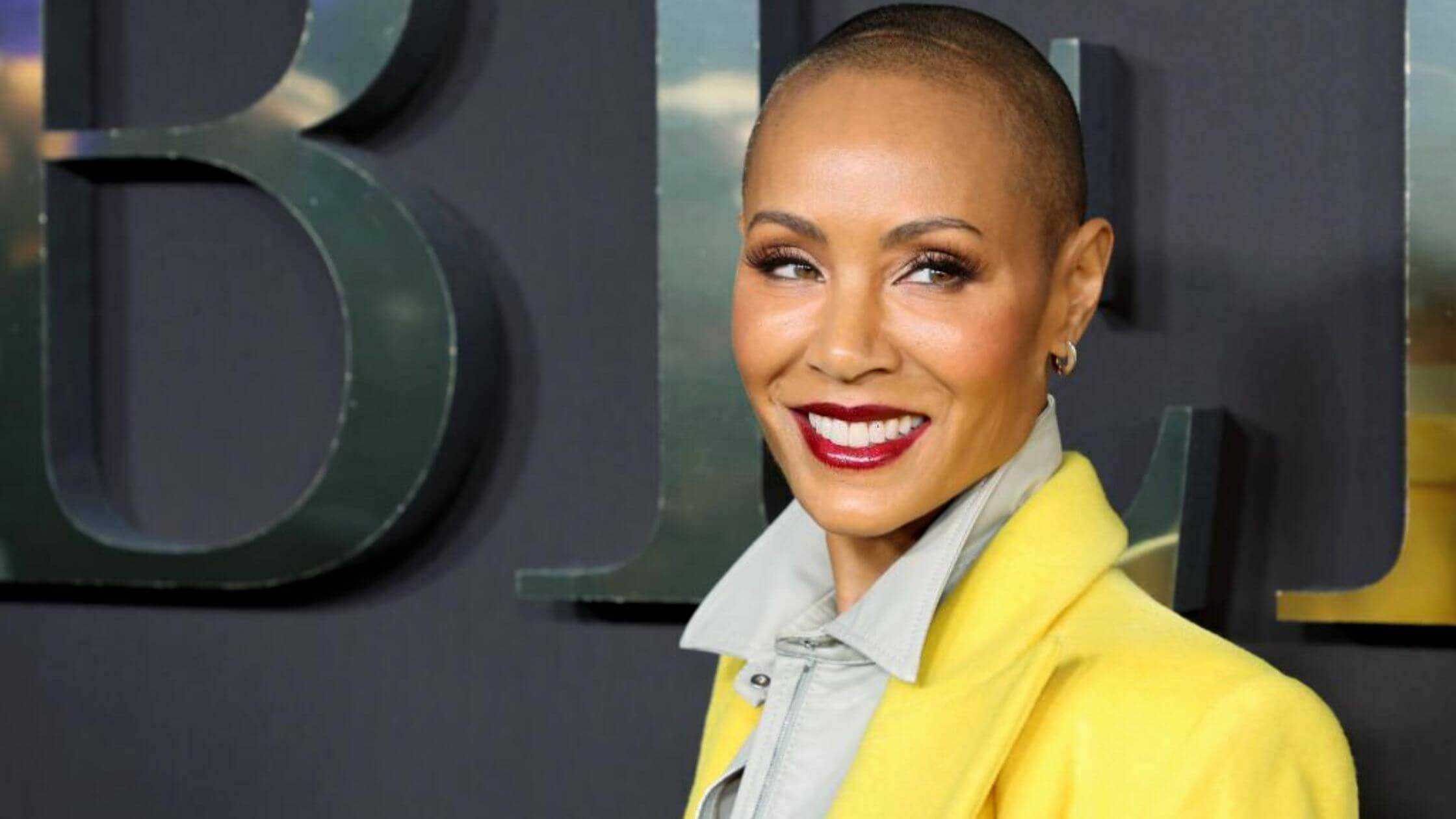 Alopecia Hair Loss Disorder- Affects Jada Pinkett Smith And Thousands Of Brits Gets Its First NHS Funding