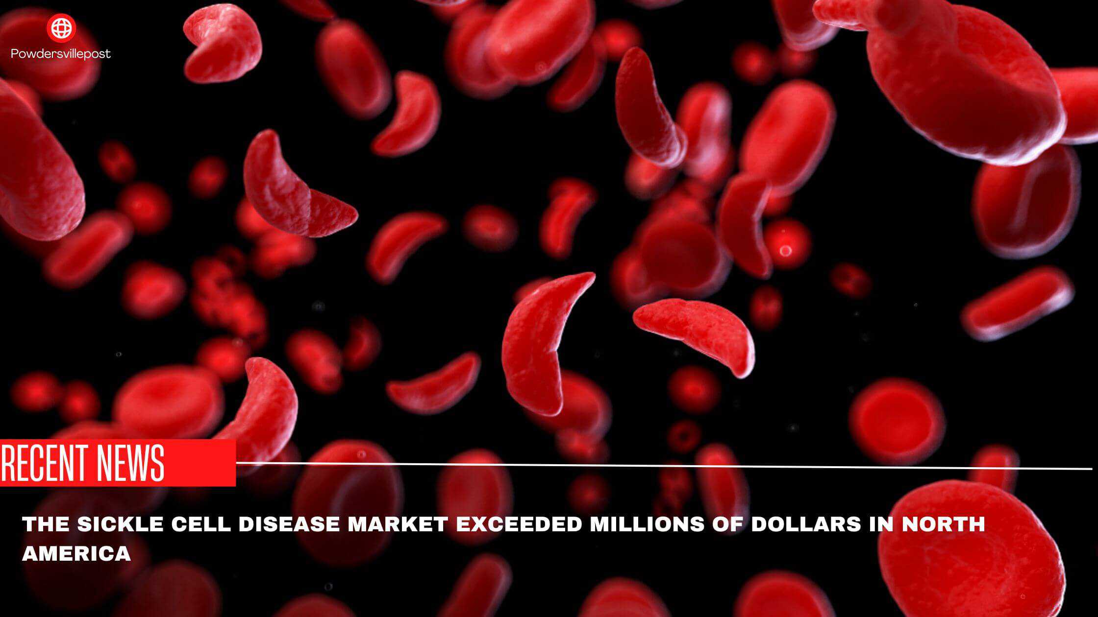 The Sickle Cell Disease Market Exceeded Millions Of Dollars In North America