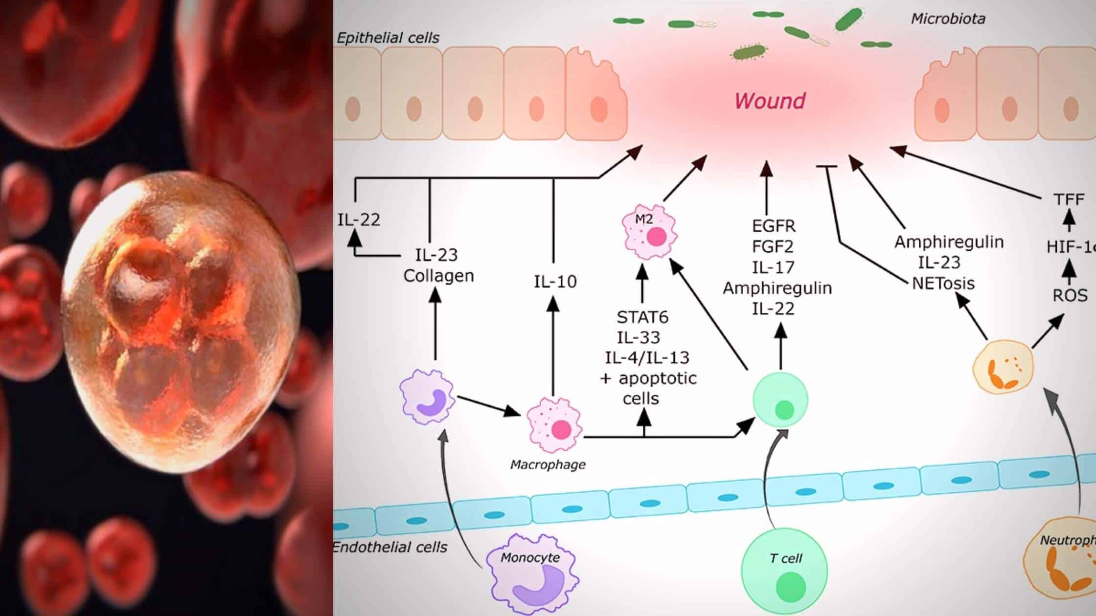 The Research Looks At How Typical Immune Cells Could Obstruct Intestinal Repair